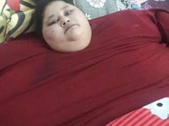 'Dünyanın en kilolu kadını' ameliyat için Hindistan'da