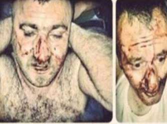 Mantar toplayan köylülere polis dayağı kameralara yansıdı