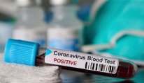 Koronavirüs’ten bir Türk hayatını kaybetti