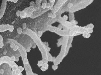 Covid-19 ilk kez böyle görüldü: Hücrelere böyle bulaşıyormuş