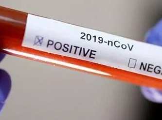 Almanya’da Covid-19 vaka sayısı 5 ayın zirvesine çıktı