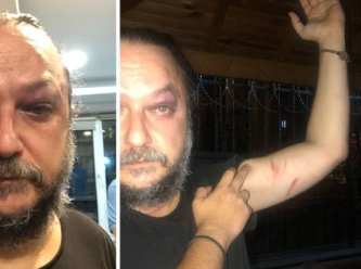 BirGün gazetesi yazarı Güvenç Dağüstün saldırıya uğradı