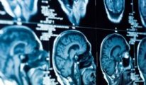 Türk araştırmacılar, stresin beyindeki 'zaman algısı'nı bozduğunu tespit etti