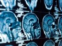 Türk araştırmacılar, stresin beyindeki 'zaman algısı'nı bozduğunu tespit etti