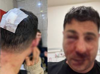 Polis aracında dakikalarca dayak, karakolda işkence