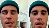 Ünlü şarkıcı Justin Bieber yüz felci geçirdi, dua istedi