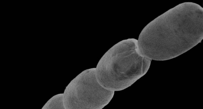 Bilimadamları şaşkın: İşte dünyanın en büyük bakterisi