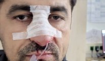 Almanya'da ırkçı saldırıya uğrayan Türk siyasetçinin burnu kırıldı