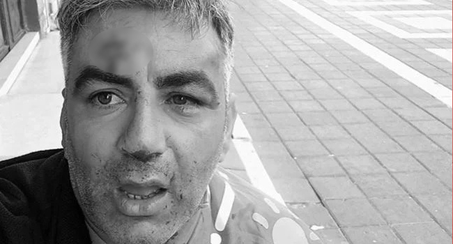 İYİ Partililere saldıranlar MHP yöneticisi çıktı