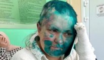 Rus gazeteci Milaşina neden Çeçenistan'da saldırıya uğradı?
