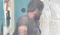 Şanlıurfa’da kuduz paniği: Hastaneden kaçtı, tarlada yakalandı