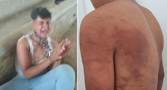 Çocuğa dayısını vurması söylendi, yapmayınca işkence ettiler!