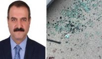 Silahlı saldırıya uğramıştı: AKP'li başkan yardımcısı aile içi husumetin kurbanı olmuş