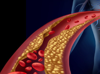 Kolesterol ne zaman tehlikeli olur?
