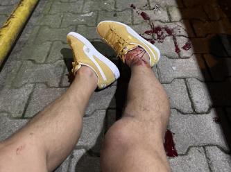 Serhat Akın'a silahlı saldırıda yeni gelişme! Beş şüpheli tutuklandı