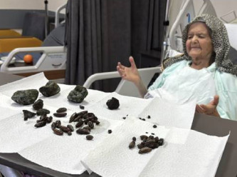 Yuttuğu zeytin ve hurma çekirdekleri içinde taşlaştı