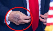 Trump’ın eline ne oldu? Beyaz Saray'dan açıklama geldi